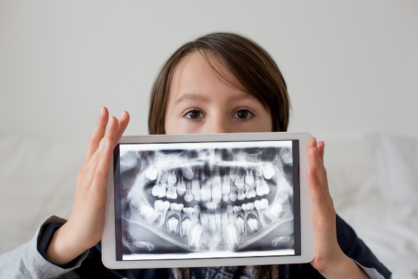 Dental Fillings For Kids:   Signs Your Child May Need A Filling