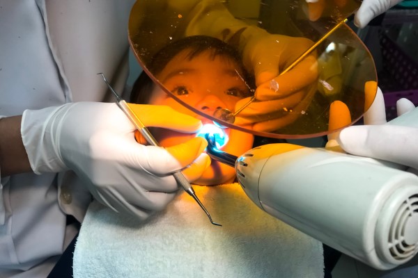Things To Know About Early Childhood Cavities