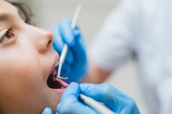 Pros And Cons Of Dental Fillings For Kids