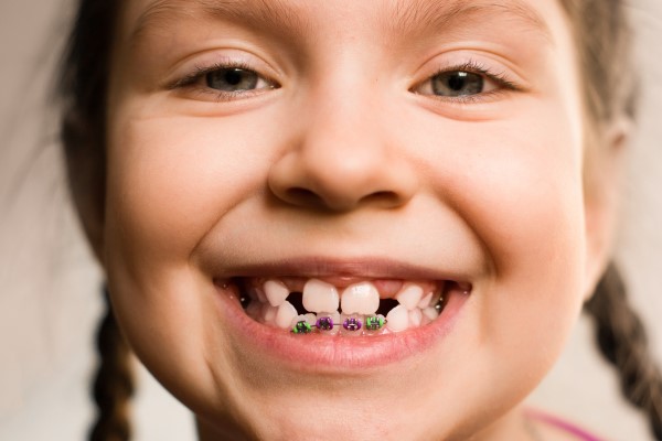 Cosmetic Dentistry For Children: Popular Options