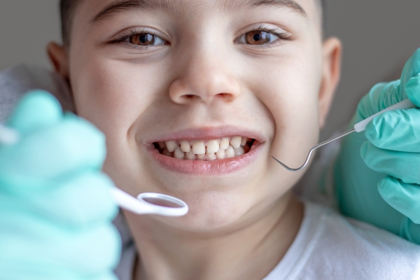How To Care For Your Child’s Smile After A Pediatric Root Canal